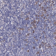 NBP1-84332 - ZC3H12B