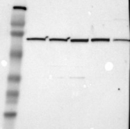 NBP1-84332 - ZC3H12B