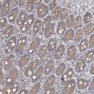 NBP1-91249 - ZC3H12D