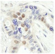 NB100-2275 - ZC3H13