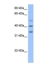NBP1-56914 - ZC3H14
