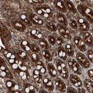 NBP1-81313 - ZC3H15
