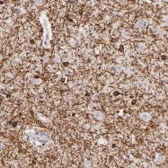 NBP1-85115 - ZC3H7B