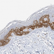 NBP1-83675 - ZCCHC12