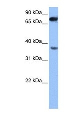 NBP1-54808 - ZCCHC12
