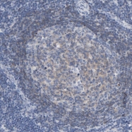 NBP1-92604 - ZCCHC13