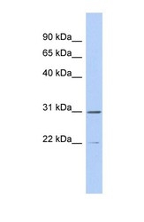 NBP1-56809 - ZCCHC13