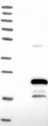 NBP1-92604 - ZCCHC13