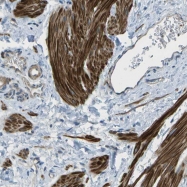 NBP1-88675 - ZCCHC14