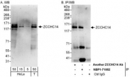 NBP1-71852 - ZCCHC14