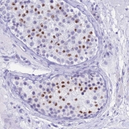 NBP1-92605 - ZCCHC17