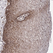 NBP1-89175 - ZCCHC7
