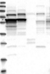 NBP1-89175 - ZCCHC7