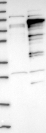 NBP1-89177 - ZCCHC7