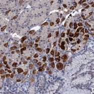 NBP1-81268 - ZCRB1