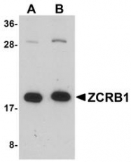 NBP1-76319 - ZCRB1