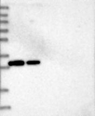 NBP1-81268 - ZCRB1