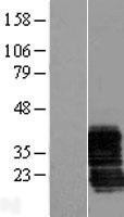 NBL1-17997 - ZCRB1 Lysate