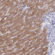 NBP1-92608 - ZDHHC14