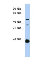 NBP1-60110 - ZDHHC14