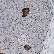 NBP1-82014 - ZDHHC15