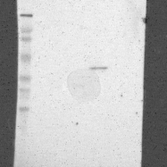 NBP1-82014 - ZDHHC15