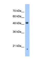 NBP1-59446 - ZDHHC16
