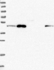 NBP1-89041 - ZDHHC16