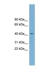 NBP1-60124 - ZDHHC18