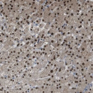 NBP1-82046 - ZDHHC20