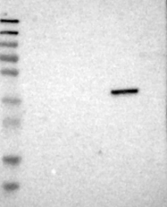 NBP1-82046 - ZDHHC20