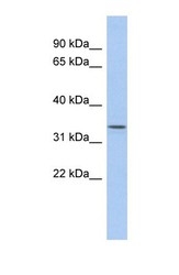 NBP1-60079 - ZDHHC24