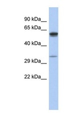 NBP1-69239 - ZDHHC24