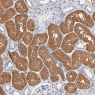 NBP1-81418 - ZDHHC8