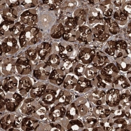NBP1-84499 - ZDHHC9