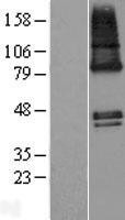 NBL1-18008 - ZDHHC9 Lysate