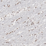 NBP1-82991 - ZFHX1B
