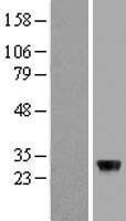 NBL1-18014 - ZFAND5 Lysate