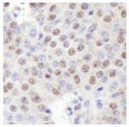 NB100-74654 - ZFP106
