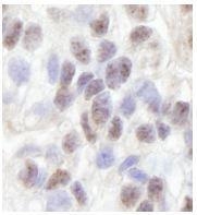 NB100-74654 - ZFP106