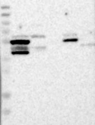 NBP1-87460 - ZNF200