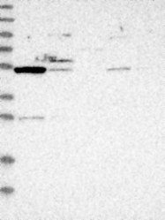 NBP1-84182 - ZSCAN21