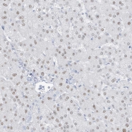 NBP1-85171 - ZFP64 (isoforms 1 and 2)