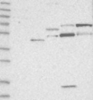 NBP1-85171 - ZFP64 (isoforms 1 and 2)