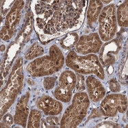 NBP1-83679 - ZFYVE19