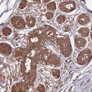 NBP1-92609 - ZGPAT