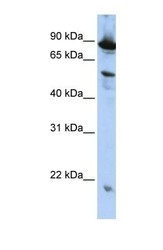 NBP1-56561 - ZGPAT
