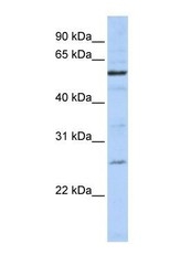NBP1-56562 - ZGPAT