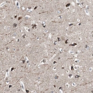 NBP1-82955 - ZHX2