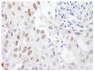 NB100-68220 - ZHX3